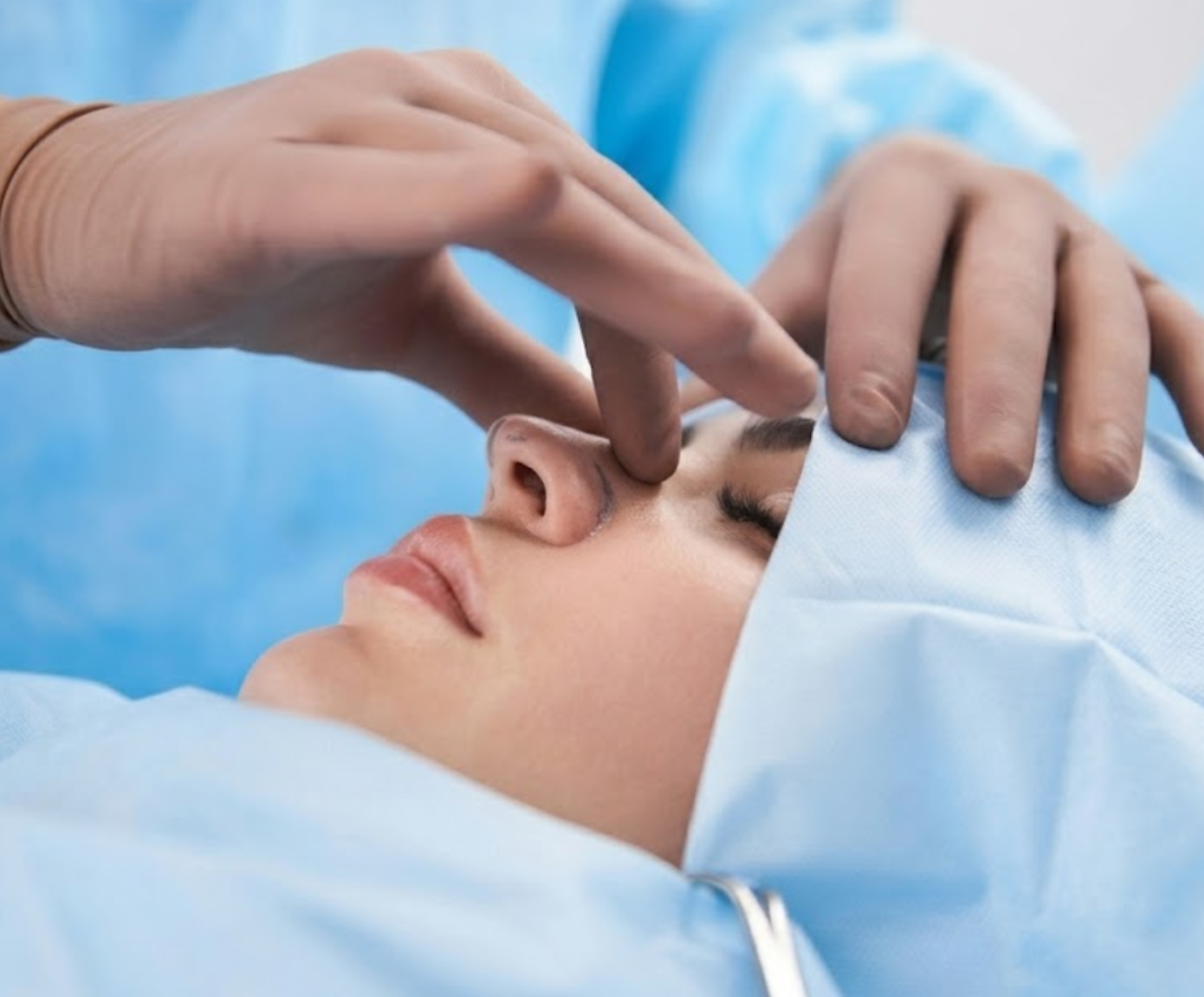 Rhinoplasty