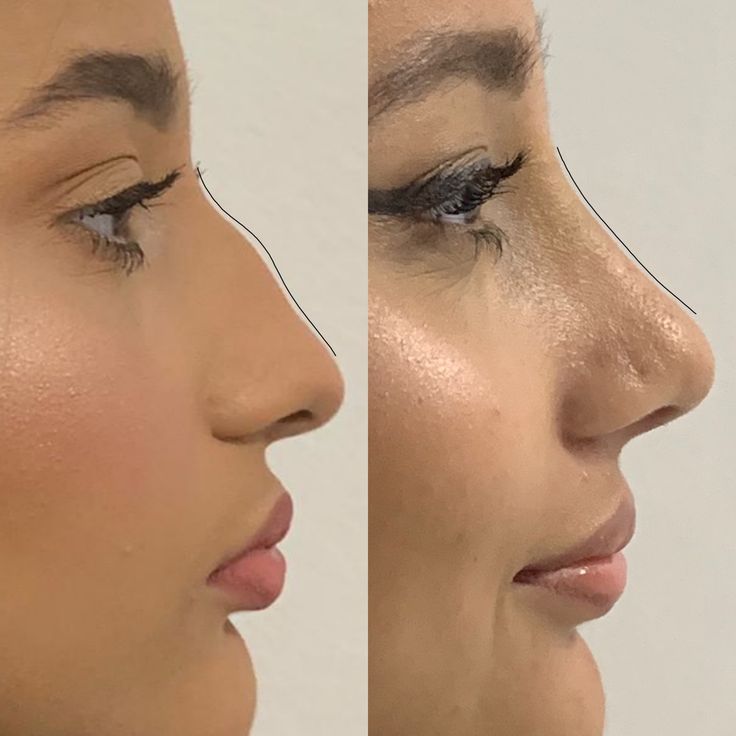General information about plastic surgery