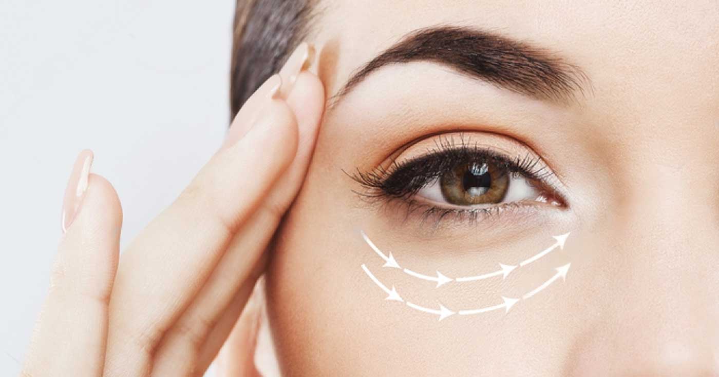 Dark Under Eye Treatment